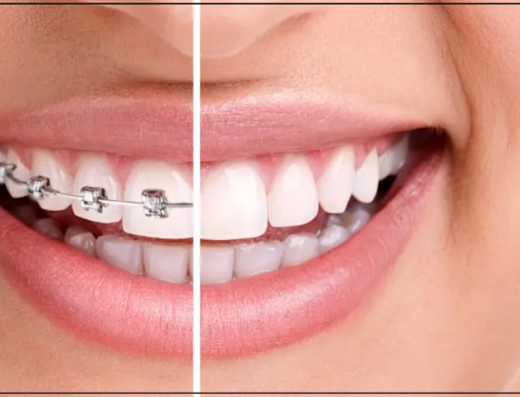 Amrita Medical Center.Dr.Fadi Ata Lahoud. .تقويم الاسنان .مركز عمريتا الطبي.د.فادي عطا لحود Orthodontist-Стоматолог-Ортодонт