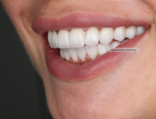 BUDOVSKY • Dental Clinic Dubai