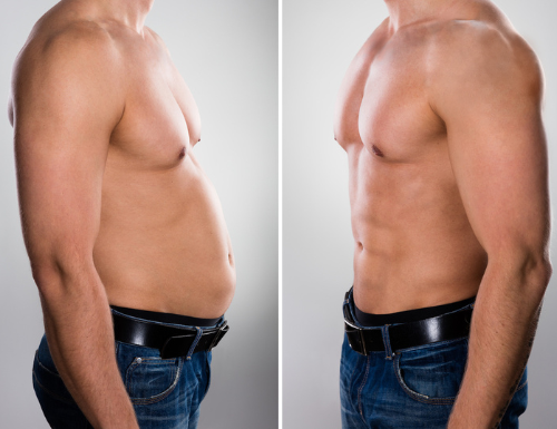 Body Sculpting Dubai – Emsculpt & Body Contouring