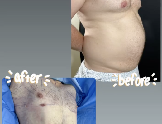Dr. Saba Al Marush – Female Plastic Surgeon in Abu Dhabi | Liposuction | Body Contouring | Breast Augmentation | BBL