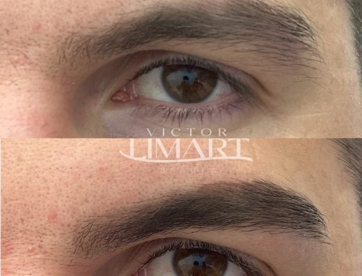 Eyebrows, Lips Victor Limart Dubai