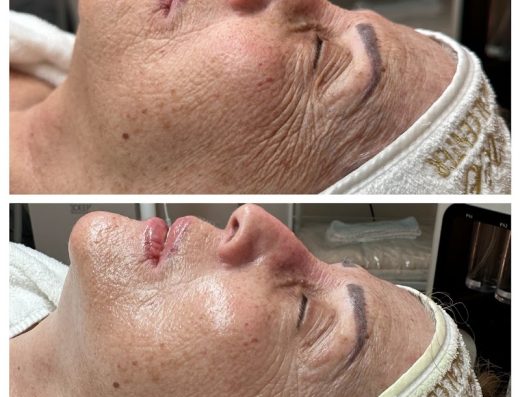 Jacq of All Skin