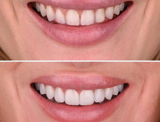 MyoSmile Polyclinic – Dental Clinic in Jumeirah