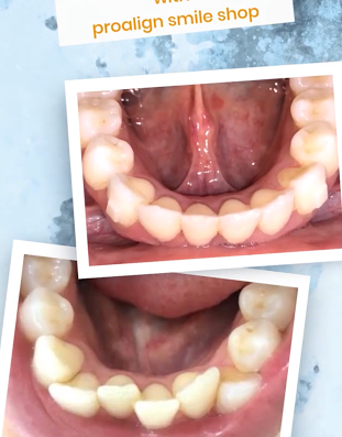 Proalign Smile Shop
