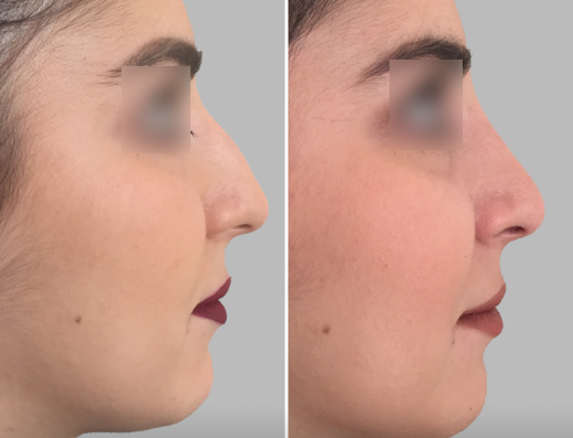 Sculpt @ excellent medical boutique