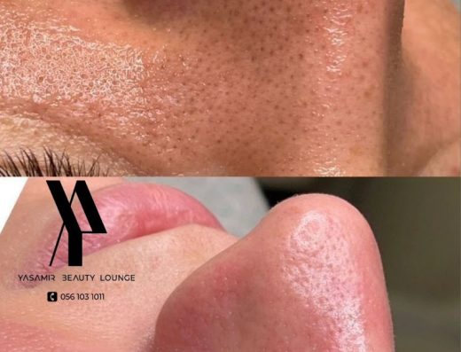 Yasamir Beauty Lounge
